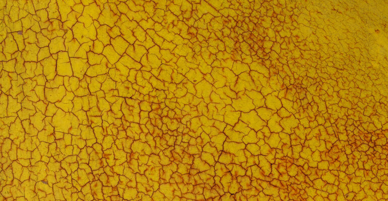 Defining Asbestosis
